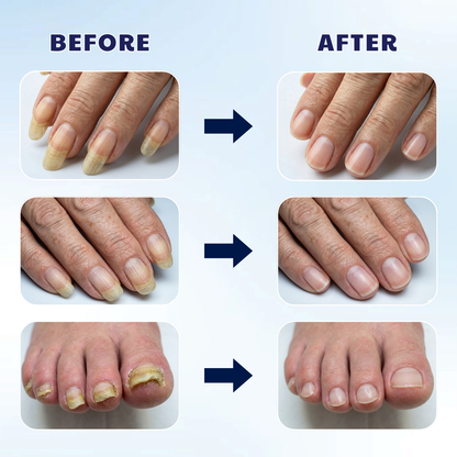 Long Handle Toe Nail Clippers for Seniors